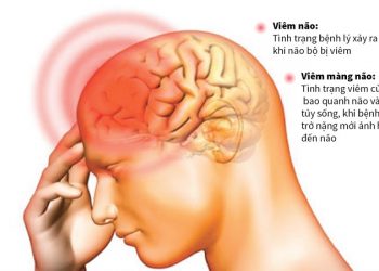 Viêm não và viêm mang não