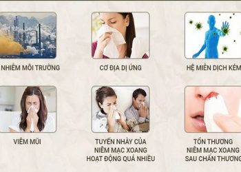 Nguyên nhân gây viêm mũi dị ứng.