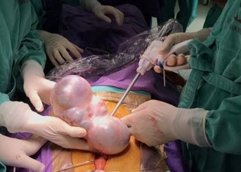 Cắt bỏ khối u khủng cho bệnh nhân ung thư buồng trứng.