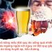 Khả năng mắc đột quỵ do uống quá nhiều rượu ngang ngửa với nguy cơ đột quỵ gây ra do tăng huyết áp, tiểu đường. (Ảnh minh họa)