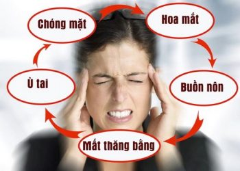Rối loại tiền đình