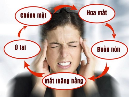 Rối loại tiền đình