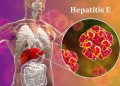 Viêm gan E nguy hiểm không kém các loại viêm gan virus khác như viêm gan B, C (Ảnh minh họa)