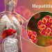 Viêm gan E nguy hiểm không kém các loại viêm gan virus khác như viêm gan B, C (Ảnh minh họa)