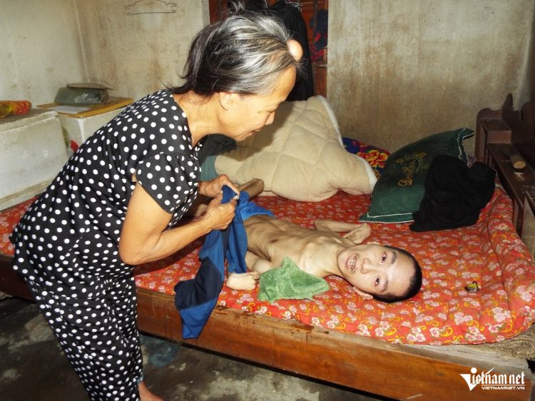 mẹ khuyết tật mang khối u lớn nuoi con bại liệt 36 năm